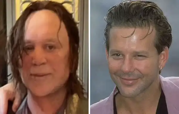 La tragica parabola di un sex symbol in parrucca