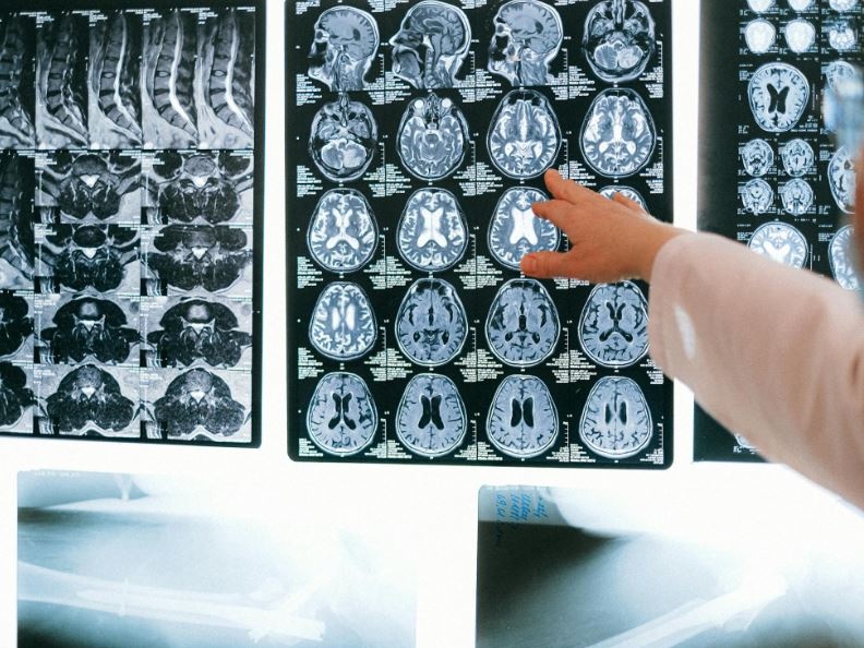 Siemens e ESR: radiologia sostenibile